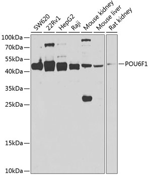 Anti-POU6F1 Antibody (CAB7299)