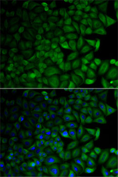 Anti-CD1D Antibody (CAB13475)