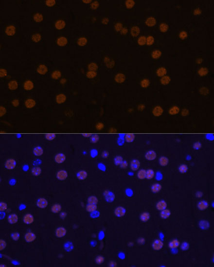 Anti-MEF2C Antibody (CAB12385)