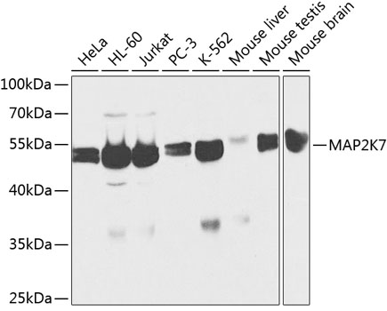 Anti-MAP2K7 Antibody (CAB2186)