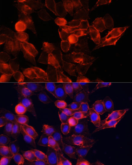 Anti-CD44 Antibody [KO Validated] (CAB12410)