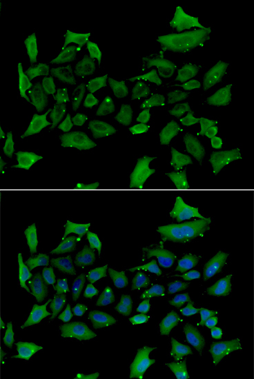 Anti-ALAS1 Antibody (CAB13462)