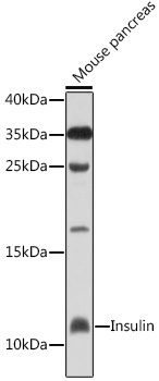 Anti-Insulin Antibody (CAB2090)