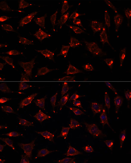 Anti-SCGB3A2 Antibody (CAB13137)