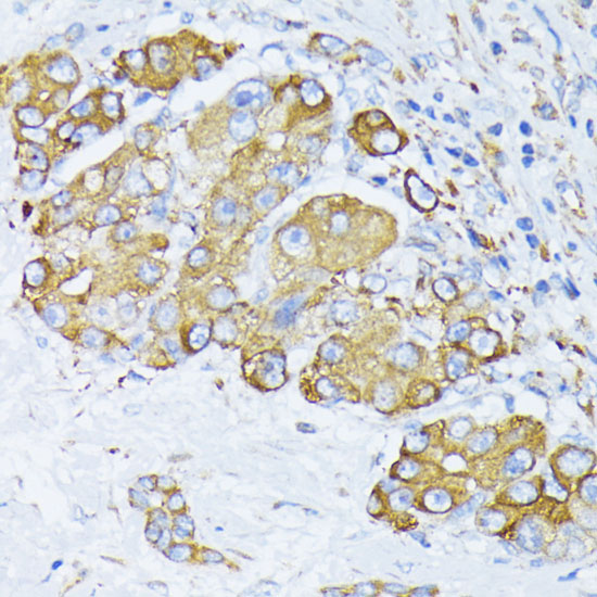 Anti-BiP/GRP78 Antibody (CAB11366)