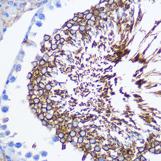 Anti-SPAM1 Antibody (CAB2120)