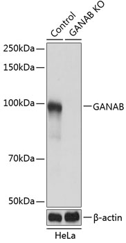 Anti-GANAB Antibody [KO Validated] (CAB19876)