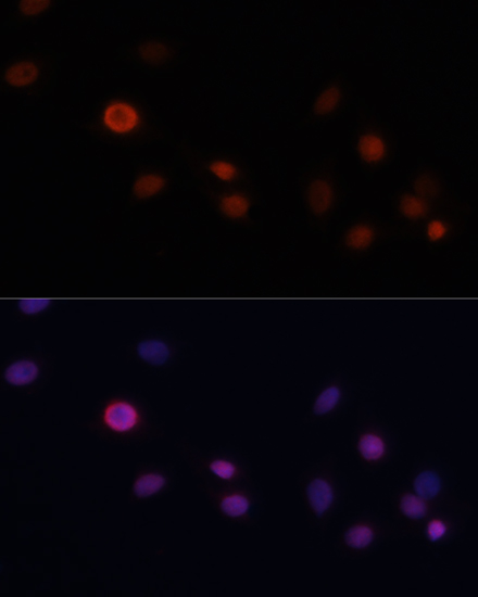 Anti-CDKN1A/p21CIP1 Antibody (CAB1483)