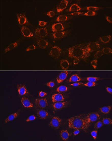 Anti-FAK Antibody (CAB11131)