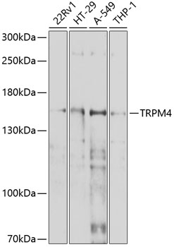 Anti-TRPM4 Antibody (CAB10146)