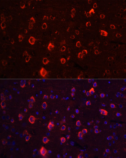 Anti-GRIA1 Antibody (CAB1826)