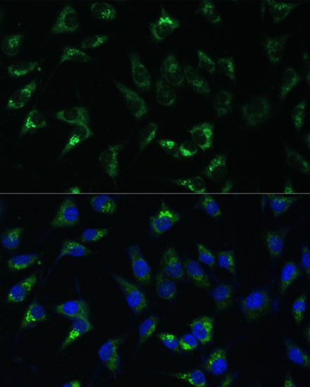 Anti-USP46 Antibody (CAB17863)