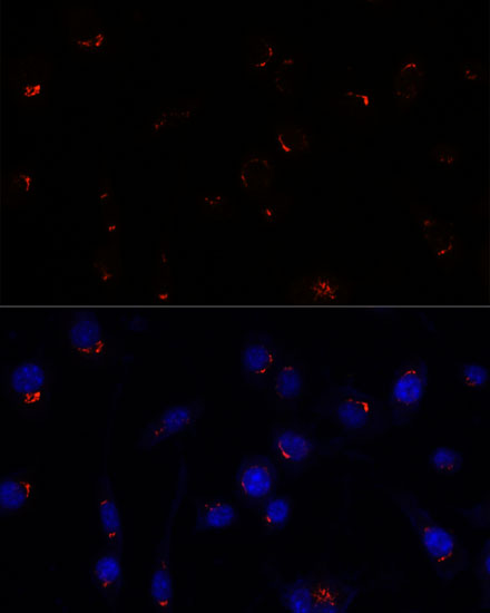 Anti-GOLGA5 Antibody (CAB15768)