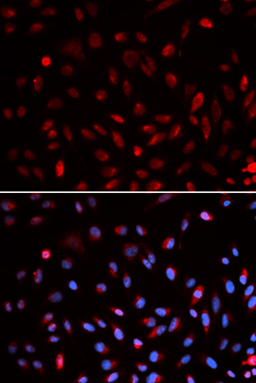 Anti-ERCC1 Antibody (CAB5291)