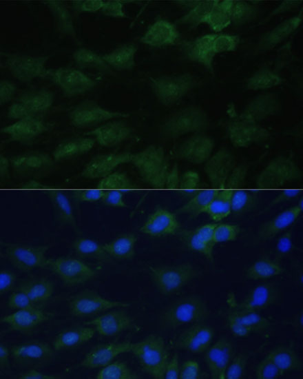 Anti-EIF1AX Antibody (CAB5917)