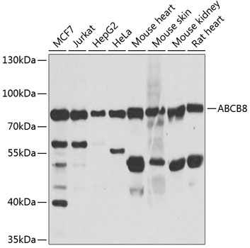 Anti-ABCB8 Antibody (CAB2653)