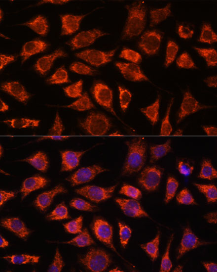 Anti-PI4KB Antibody (CAB16416)