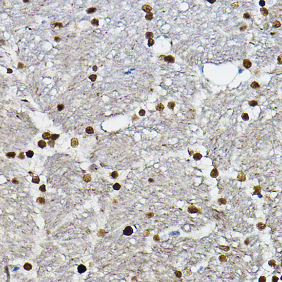 Anti-SOX10 Polyclonal Antibody (CAB8635)