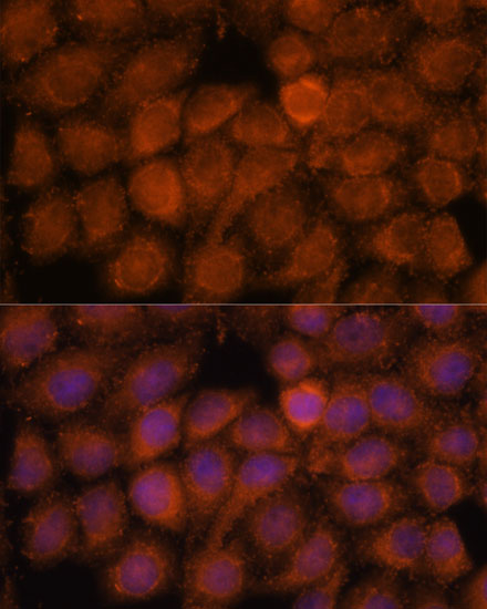 Anti-NDUFAF4 Antibody (CAB14345)