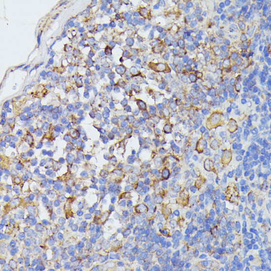 Anti-STAT1 Antibody (CAB12075)