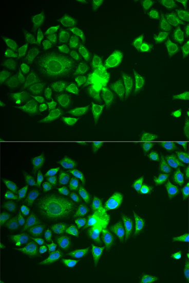 Anti-NDUFS4 Antibody (CAB13519)