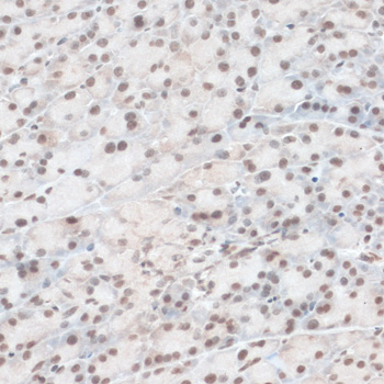 Anti-ZNF574 Antibody (CAB14923)