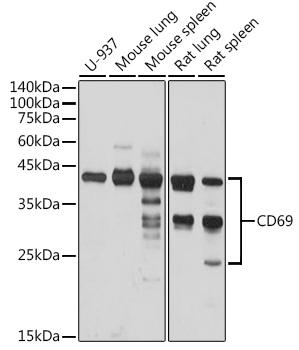 Anti-CD69 Antibody (CAB2045)