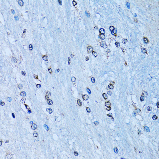 NF-kB2 Rabbit Polyclonal Antibody (CAB3108)