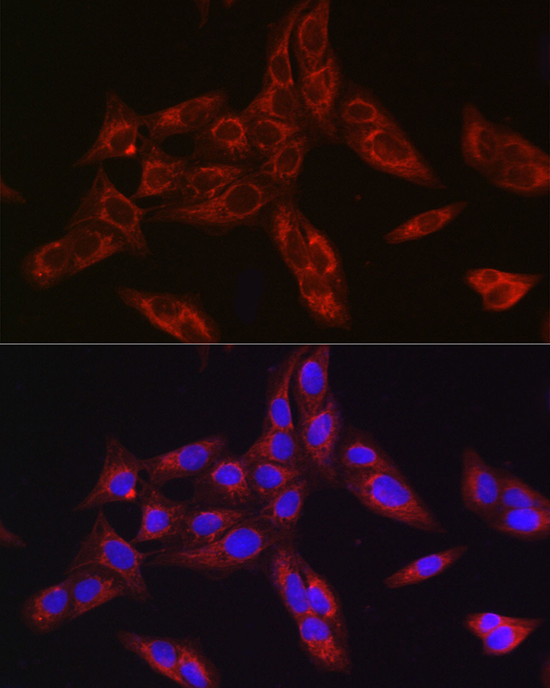 Anti-FURIN Antibody (CAB7445)