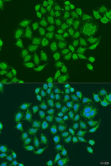 Anti-PRDM10 Antibody (CAB15176)