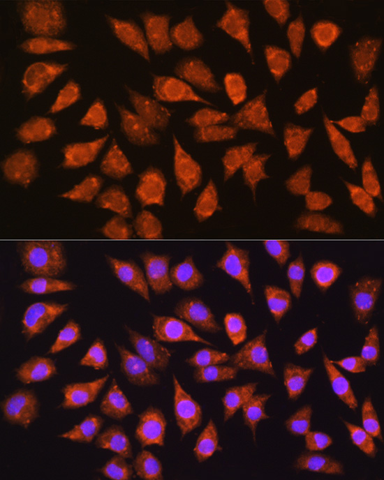 Anti-IMPDH1 Polyclonal Antibody (CAB9497)