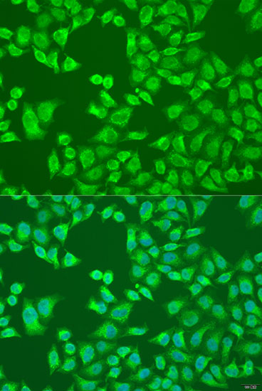 Anti-IFNL3 Antibody (CAB12908)