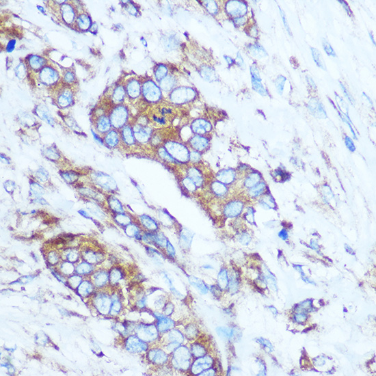 Anti-GSTT1 Antibody (CAB1287)