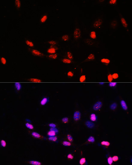 Anti-COPS5 Antibody (CAB13401)