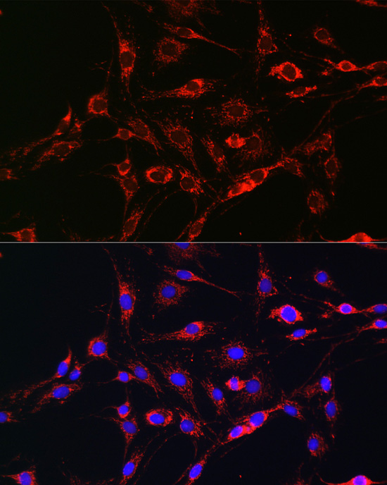 Anti-RAB5A Antibody [KO Validated] (CAB1180)