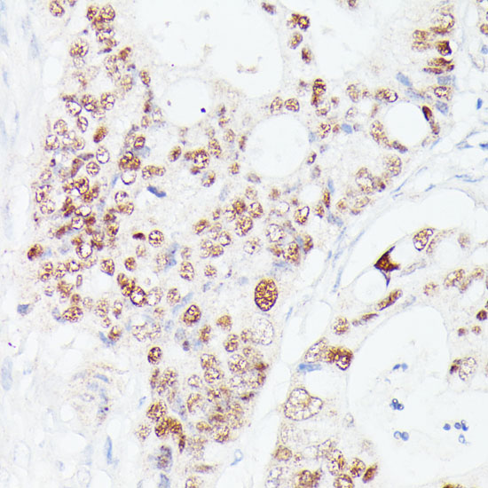 Anti-p53 Antibody [KO Validated] (CAB11232)