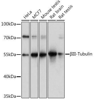 Anti-BetaIII-Tubulin Antibody (CAB17073)