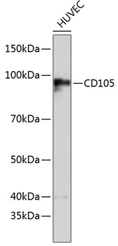 Anti-CD105 Antibody (CAB19008)