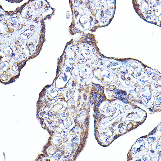 Anti-PDK4 Antibody (CAB3069)