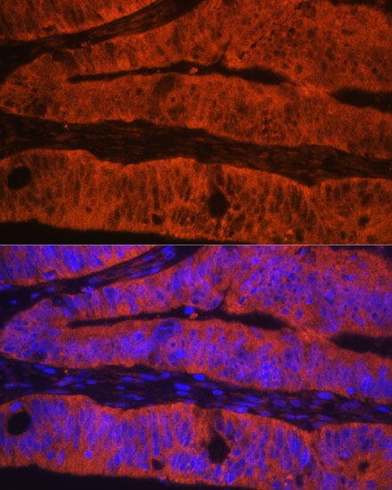 Anti-TLN1 Antibody (CAB4158)