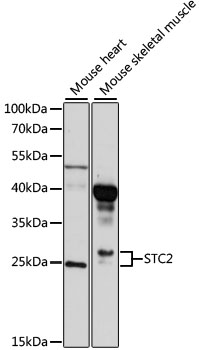 Anti-STC2 Antibody (CAB10397)