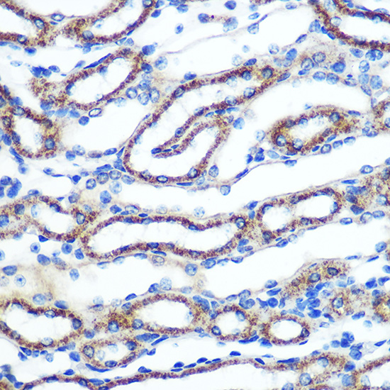 Anti-ABCA1 Antibody (CAB16337)