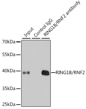 Anti-RING1B/RNF2 Antibody (CAB5563)