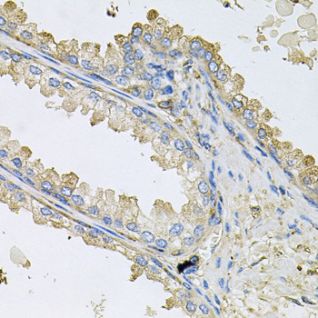 Anti-PPIC Polyclonal Antibody (CAB9837)