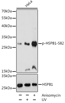 Anti-Phospho-HSPB1-S82 Antibody (CABP0041)