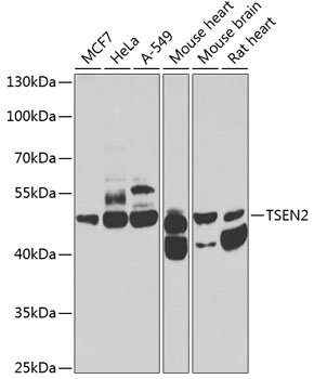 Anti-TSEN2 Antibody (CAB7838)