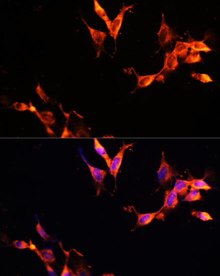 Anti-LAMTOR1 Antibody (CAB11619)