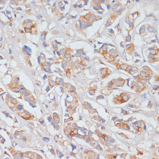 Anti-DLL1 Antibody (CAB14277)