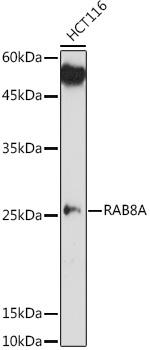 Western blot analysis of extracts of HCT116 cells, using RAB8A antibody at 1:1000 dilution. Secondary antibody: HRP Goat Anti-Rabbit IgG (H+L) at 1:10000 dilution. Lysates/proteins: 25ug per lane. Blocking buffer: 3% nonfat dry milk in TBST. Detection: ECL Enhanced Kit. Exposure time: 180s.