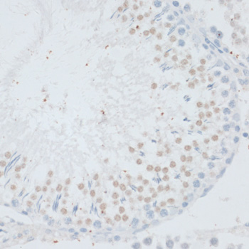 Anti-DNMT3B Antibody (CAB7239)